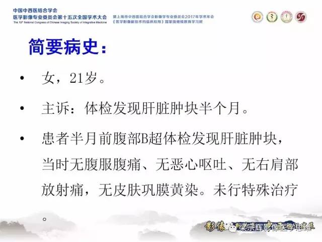 【病例】不典型肝脏海绵状血管瘤1例MR影像表现