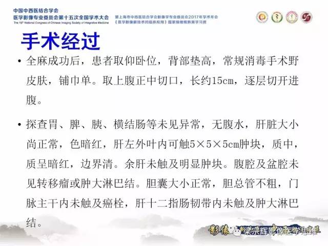 【病例】不典型肝脏海绵状血管瘤1例MR影像表现