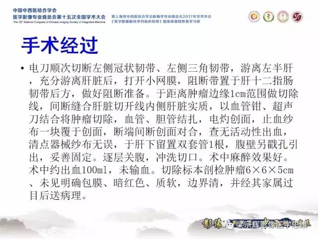 【病例】不典型肝脏海绵状血管瘤1例MR影像表现