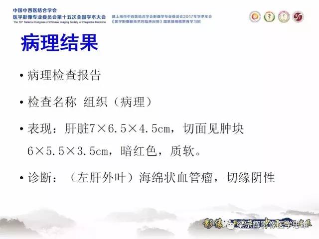 【病例】不典型肝脏海绵状血管瘤1例MR影像表现