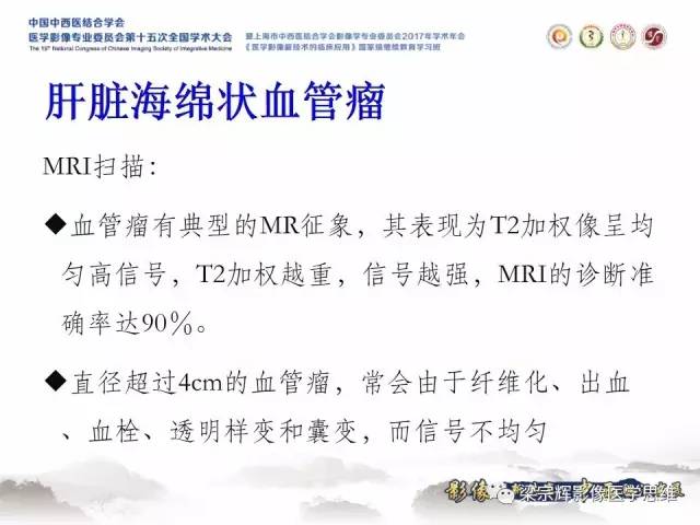 【病例】不典型肝脏海绵状血管瘤1例MR影像表现