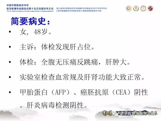 【病例】肝脏原发性淋巴瘤1例MR影像表现