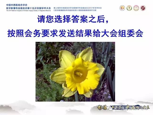 【病例】肝脏原发性淋巴瘤1例MR影像表现