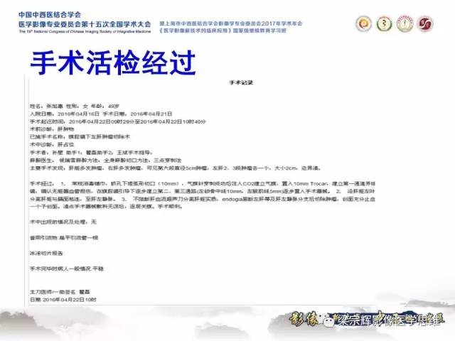 【病例】肝脏原发性淋巴瘤1例MR影像表现