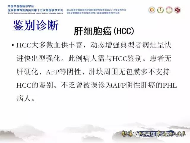 【病例】肝脏原发性淋巴瘤1例MR影像表现