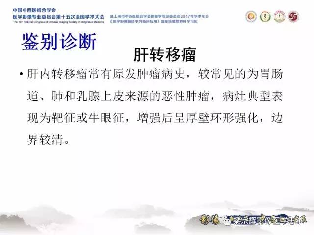 【病例】肝脏原发性淋巴瘤1例MR影像表现