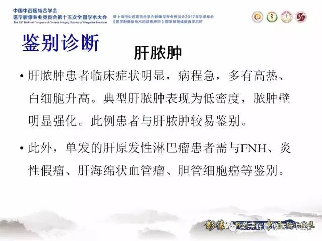 【病例】肝脏原发性淋巴瘤1例MR影像表现