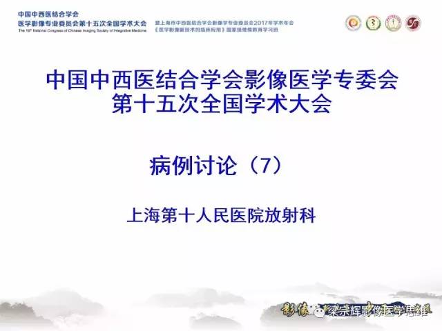【病例】睾丸精原细胞瘤1例MR影像表现