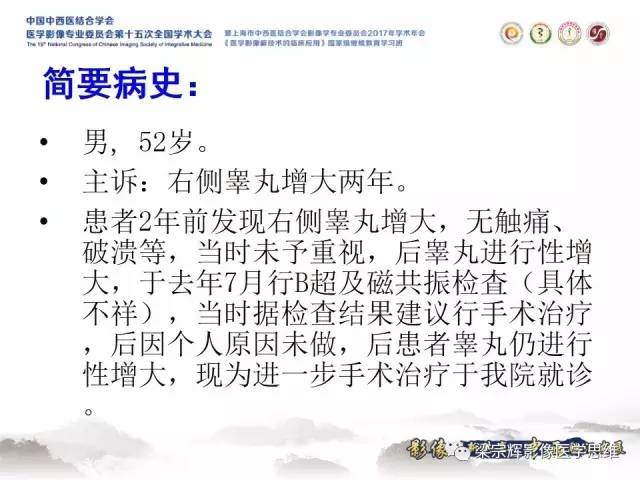 【病例】睾丸精原细胞瘤1例MR影像表现