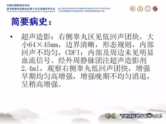 【病例】睾丸精原细胞瘤1例MR影像表现