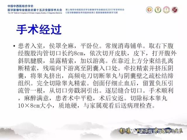 【病例】睾丸精原细胞瘤1例MR影像表现
