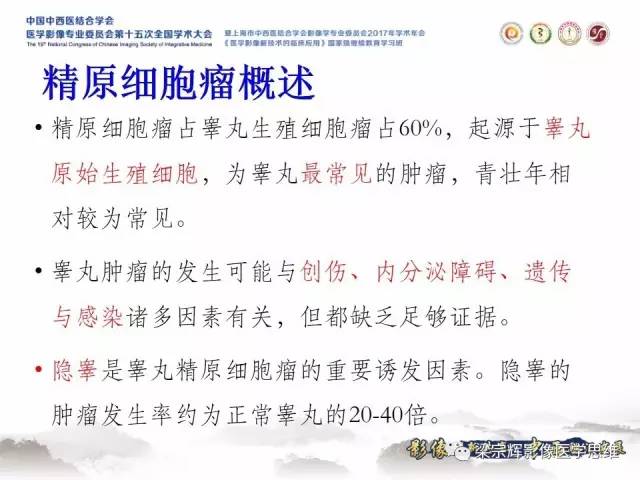 【病例】睾丸精原细胞瘤1例MR影像表现