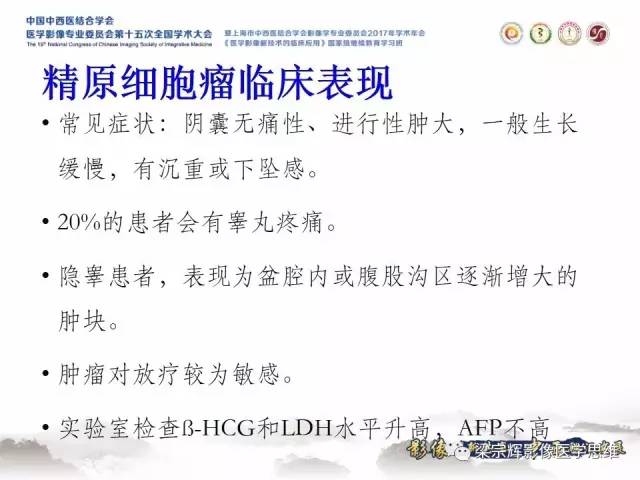 【病例】睾丸精原细胞瘤1例MR影像表现