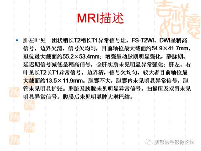 【病例】肝左外叶局灶性结节性增生FNH一例MR 【病例】肝左外叶局灶性结节性增生FNH一例MR