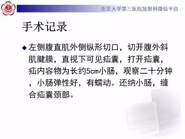 【病例】半月线疝1例CT影像表现