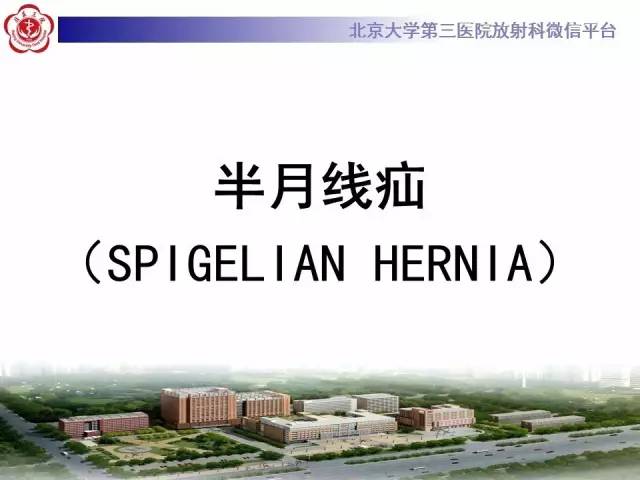 【病例】半月线疝1例CT影像表现