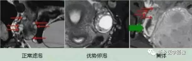 自动草稿