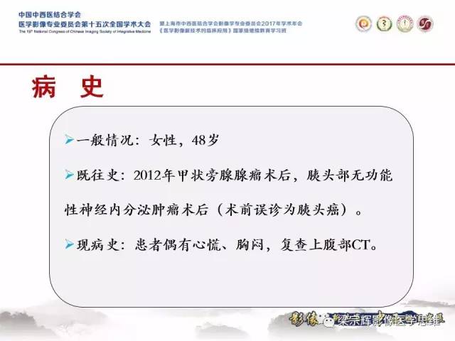 【病例】多发性内分泌肿瘤1例CT