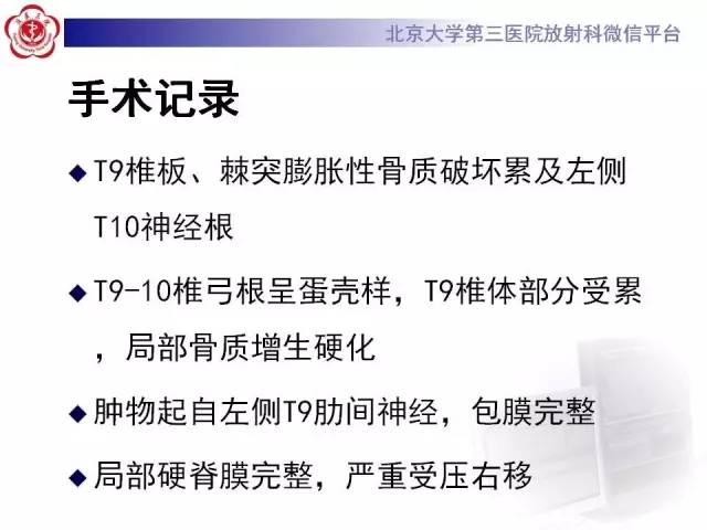 【病例】脊柱神经鞘瘤1例CT及MR