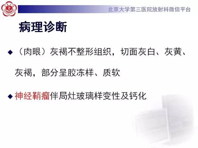 【病例】脊柱神经鞘瘤1例CT及MR