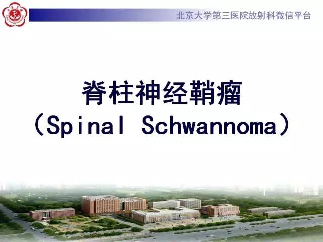【病例】脊柱神经鞘瘤1例CT及MR