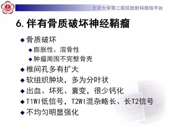 【病例】脊柱神经鞘瘤1例CT及MR
