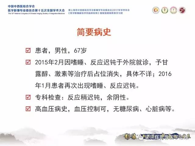 【病例】中枢神经系统淋巴瘤1例MR
