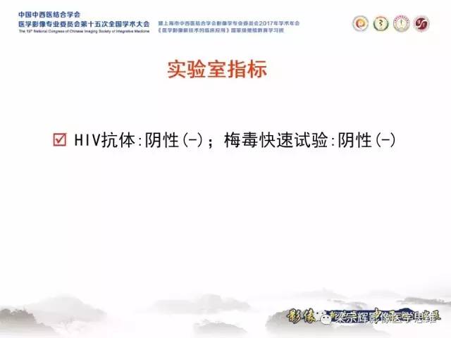 【病例】中枢神经系统淋巴瘤1例MR