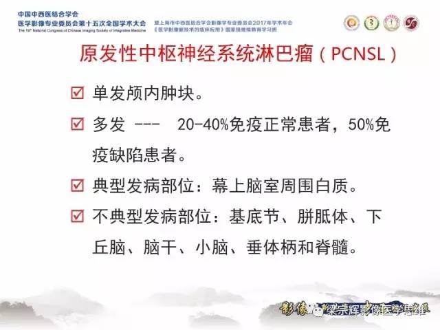【病例】中枢神经系统淋巴瘤1例MR