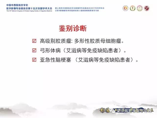 【病例】中枢神经系统淋巴瘤1例MR