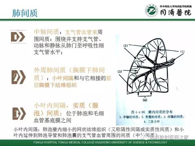 【PPT】间质性肺疾病的影响学表现