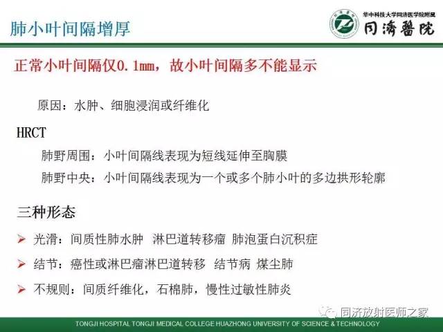 【PPT】间质性肺疾病的影响学表现
