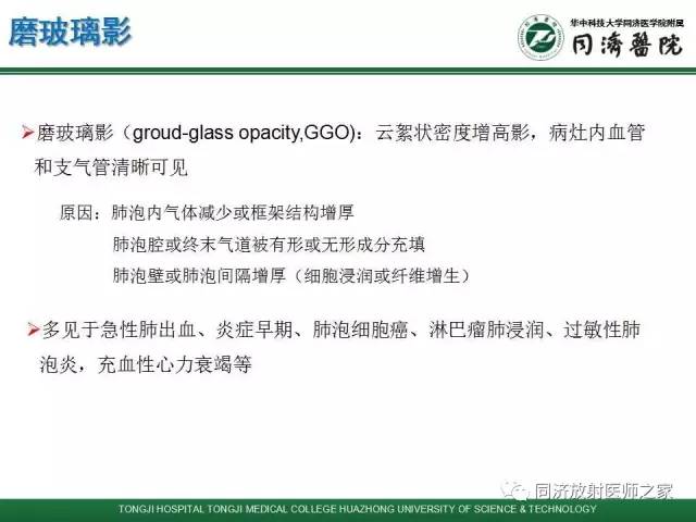 【PPT】间质性肺疾病的影响学表现