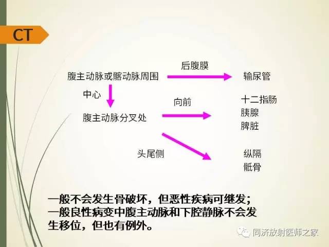 【PPT】腹膜后纤维化