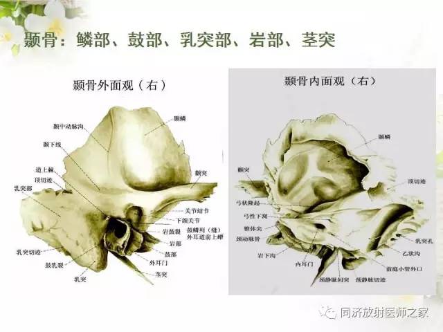 【PPT】耳部CT影像解剖及常见病的认识
