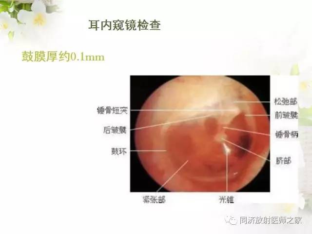 【PPT】耳部CT影像解剖及常见病的认识