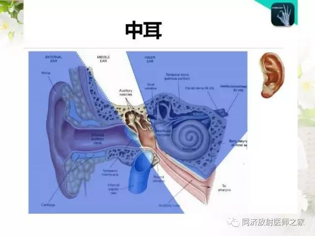 【PPT】耳部CT影像解剖及常见病的认识
