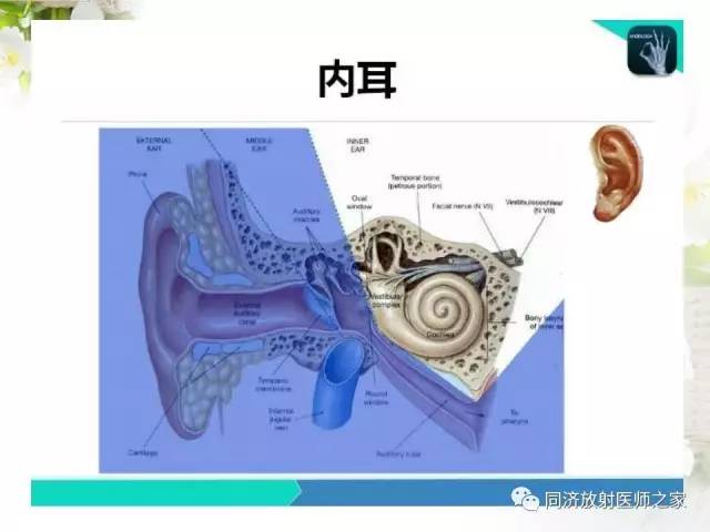 【PPT】耳部CT影像解剖及常见病的认识
