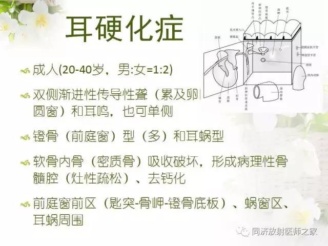 【PPT】耳部CT影像解剖及常见病的认识