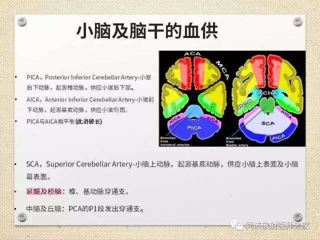 【PPT】超急性期脑梗塞的CT诊断