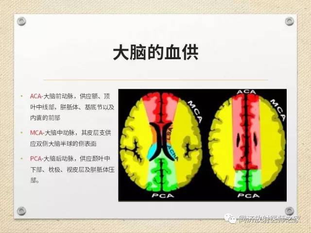 【PPT】超急性期脑梗塞的CT诊断