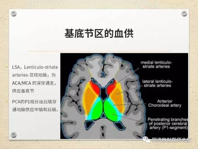 【PPT】超急性期脑梗塞的CT诊断