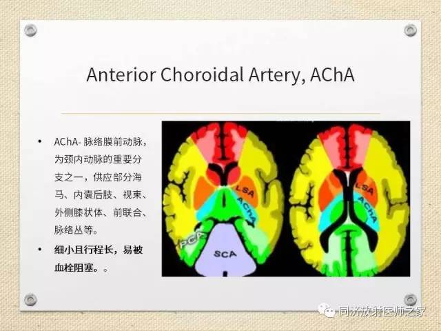 【PPT】超急性期脑梗塞的CT诊断
