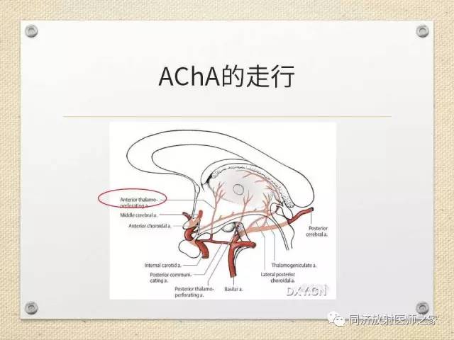 【PPT】超急性期脑梗塞的CT诊断