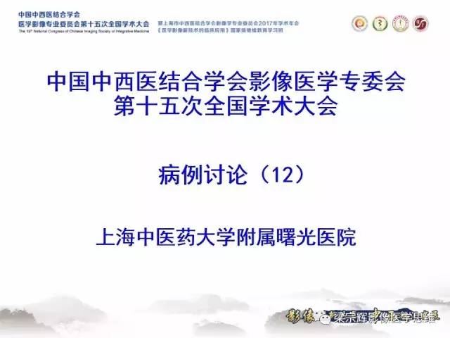 【病例】肝糖原累积症伴肝腺瘤1例MR
