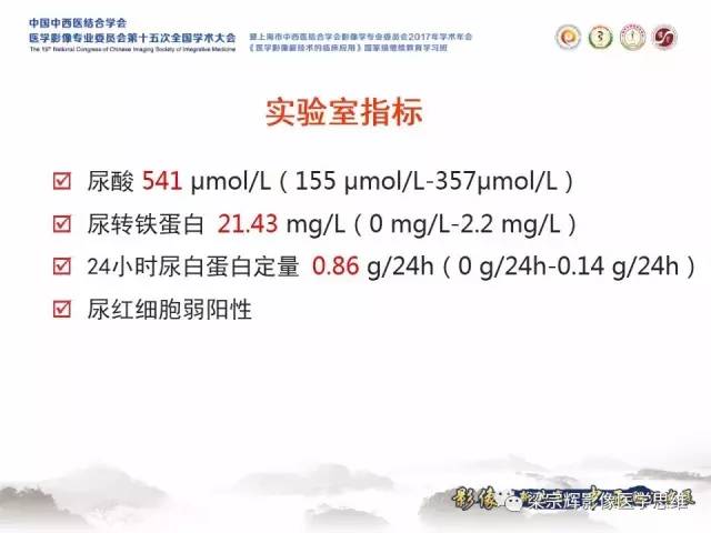 【病例】肝糖原累积症伴肝腺瘤1例MR