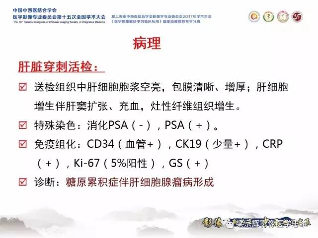 【病例】肝糖原累积症伴肝腺瘤1例MR