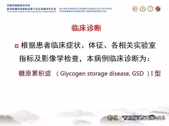 【病例】肝糖原累积症伴肝腺瘤1例MR