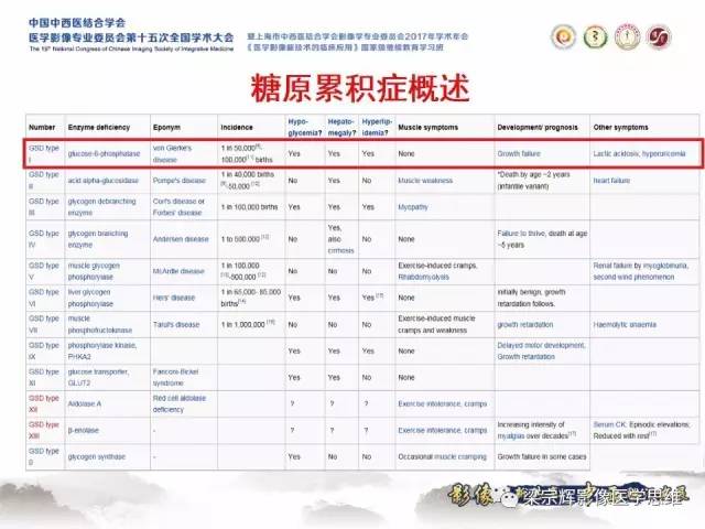 【病例】肝糖原累积症伴肝腺瘤1例MR