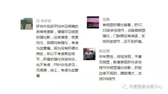 【病例】肝硬化伴海绵状血管瘤1例 【病例】肝硬化伴海绵状血管瘤1例